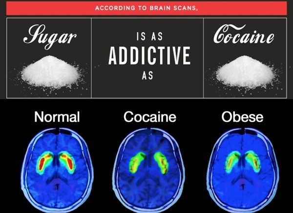 Sugar Addiction is Real, Science Says