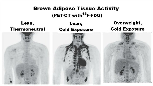 Cold Thermogenesis 5 Good Tips Yuri Elkaim