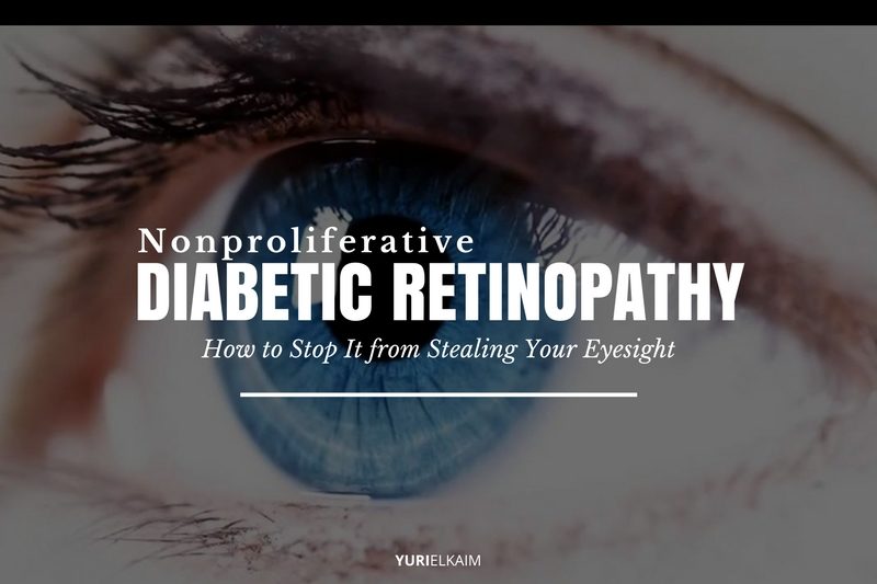 Nonproliferative Diabetic Retinopathy - How to Stop It from Stealing Your Eyesight