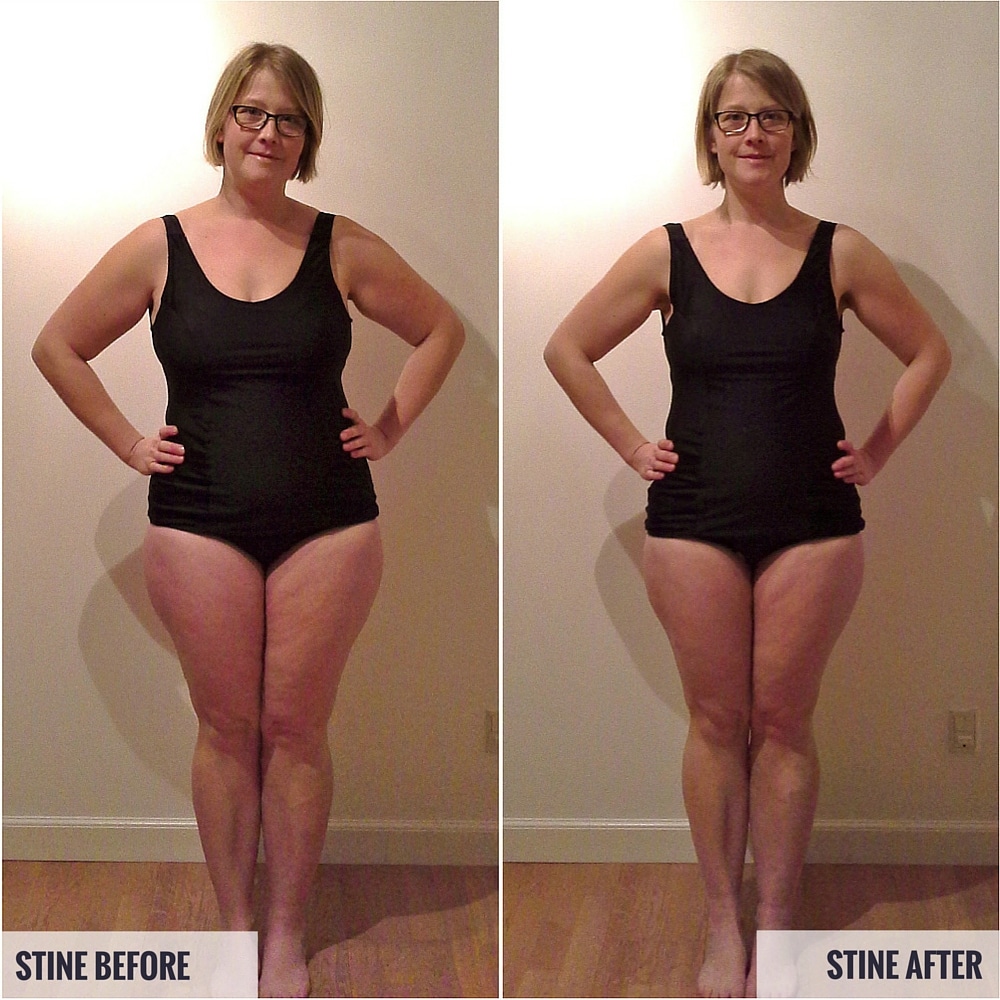 Stine Before and After Photos
