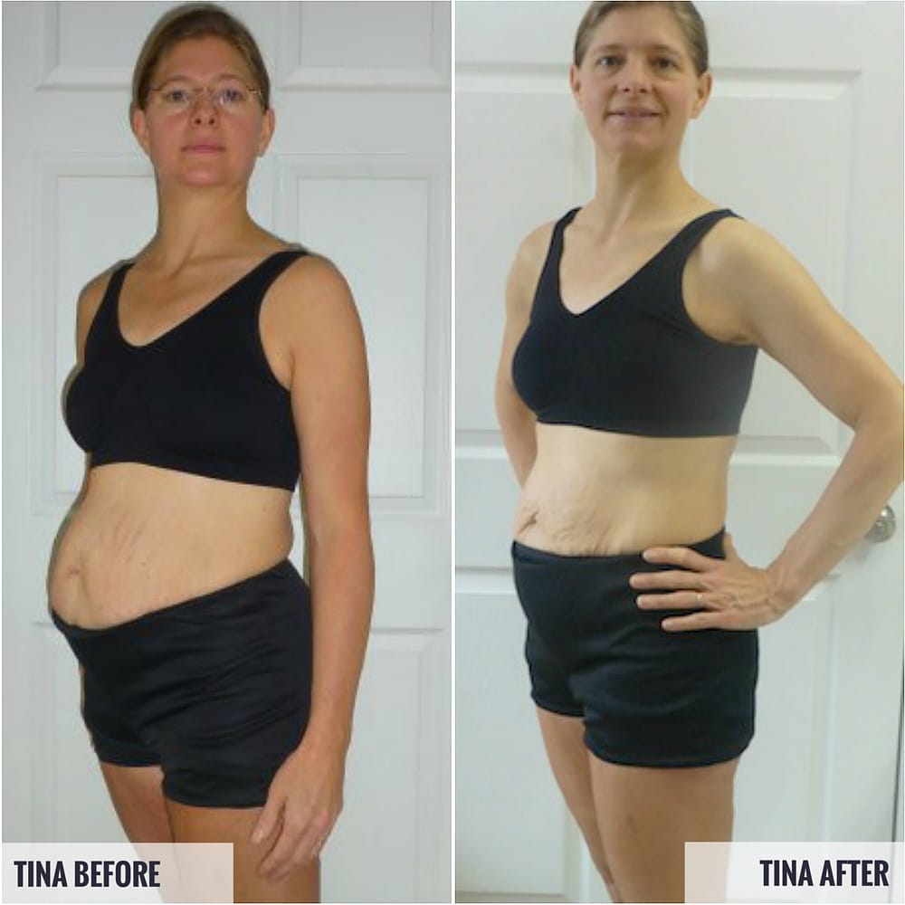 Tina Before and After Photos