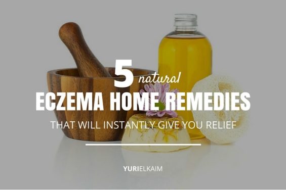 5 Home Remedies for Eczema That Will Relieve Itchiness | Yuri Elkaim