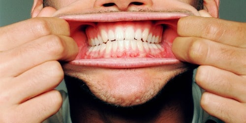 Man's mouth and gums