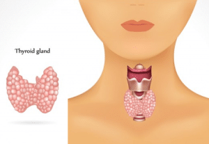 Is Hypothyroidism an Autoimmune Disease? Here's the Truth | Yuri Elkaim