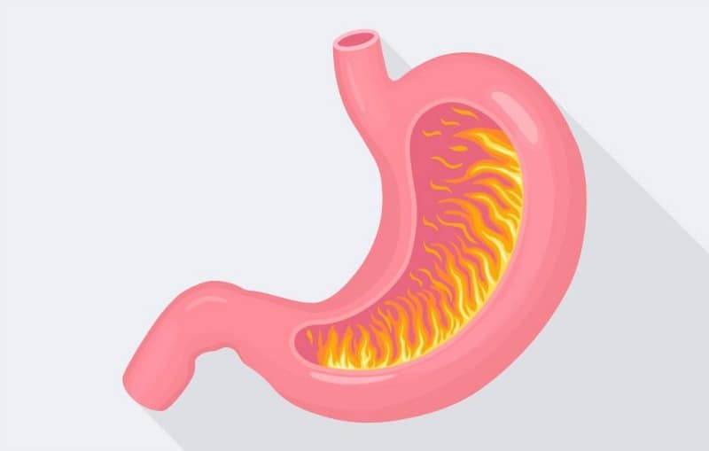 How to Relieve Heartburn Naturally (7 Ways That Actually Work)