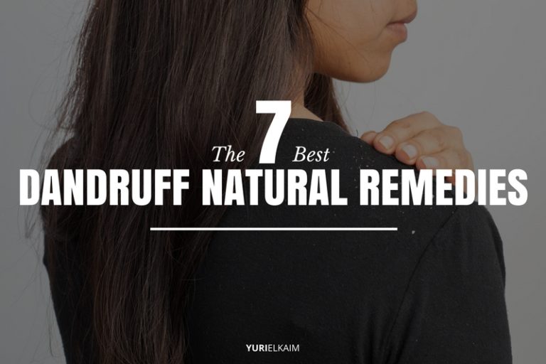 7 Best Natural Remedies for Dandruff and Itchy Scalp Yuri Elkaim