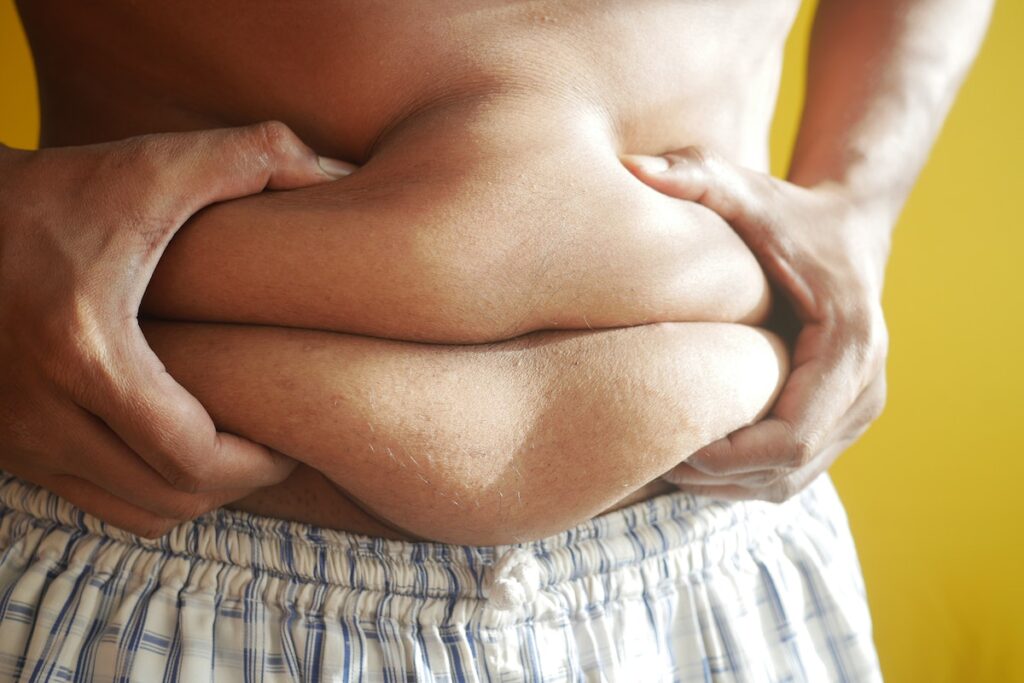Image of a man holding his belly fat. Pexels.